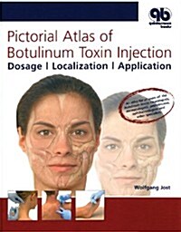 Pictorial Atlas of Botulinum Toxin Injection: Dosage, Localization, Application (Hardcover, 2, 2012, Revised)