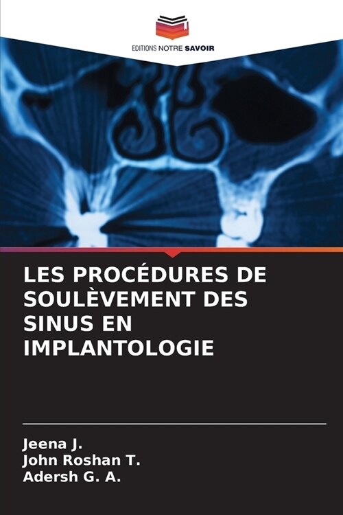 Les Proc?ures de Soul?ement Des Sinus En Implantologie (Paperback)