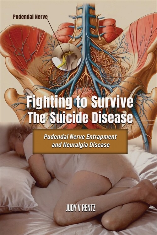 Fighting to Survive The Suicide Disease: Pudendal Nerve Entrapment and Neuralgia Disease (Paperback)