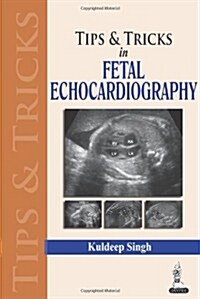 Tips & Tricks in Fetal Echocardiography (Paperback)