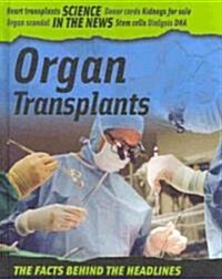 Organ Transplants (Library Binding)