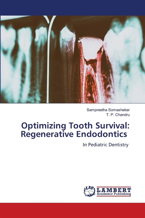 Optimizing Tooth Survival: Regenerative Endodontics (Paperback)