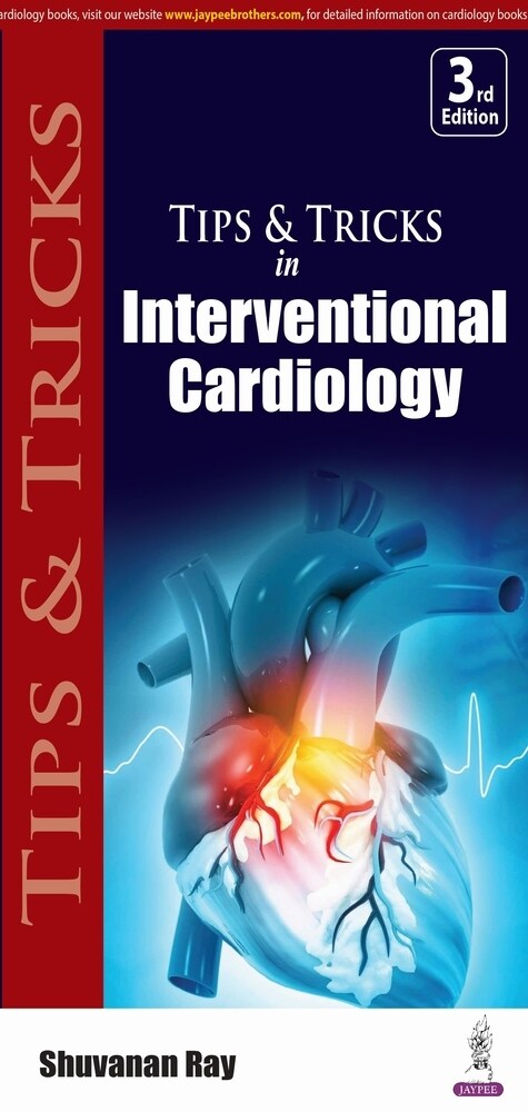 Tips & Tricks in Interventional Cardiology (Paperback, 3 Revised edition)