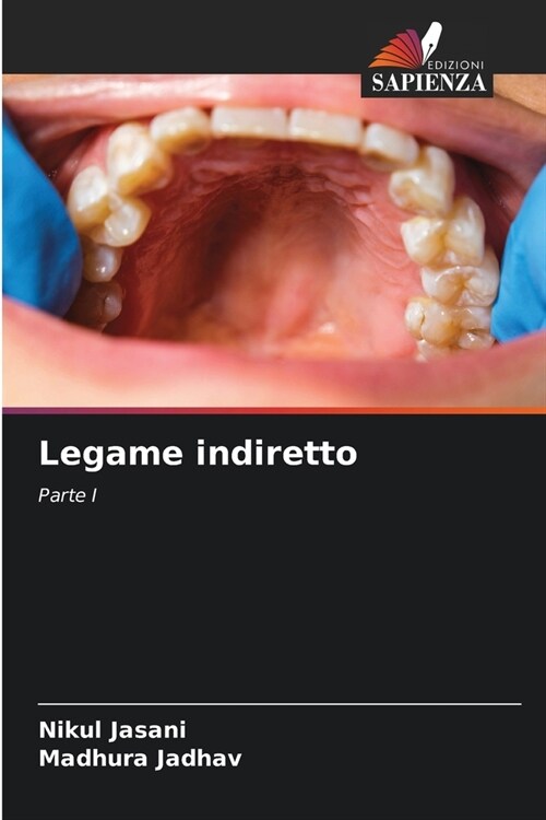 Legame indiretto (Paperback)