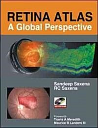 Retina Atlas: A Global Perspective (Hardcover)