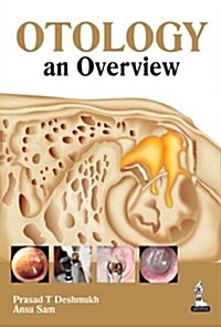 Otology: An Overview (Paperback)
