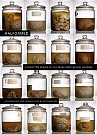 Malformed: Forgotten Brains of the Texas State Mental Hospital (Hardcover)