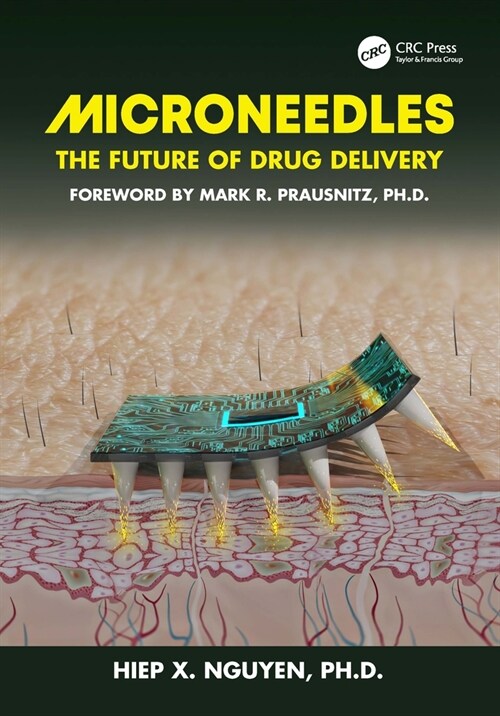 Microneedles : The Future of Drug Delivery (Paperback)