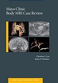 Mayo Clinic Body MRI Case Review (Hardcover, 1st, PCK)
