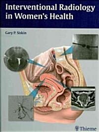 Interventional Radiology in Womens Health (Hardcover, 1st)