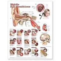 Middle Ear Conditions Anatomical Chart (Other, 2)
