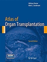 Atlas of Organ Transplantation (Hardcover, 2nd ed. 2015)