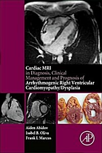 Cardiac MRI in Diagnosis, Clinical Management, and Prognosis of Arrhythmogenic Right Ventricular Cardiomyopathy/Dysplasia (Paperback)