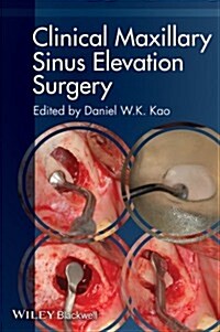 Clinical Maxillary Sinus Elevation Surgery (Paperback, 1st)