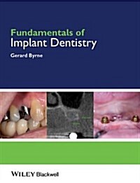 Fundamentals of Implant Dentistry (Paperback)