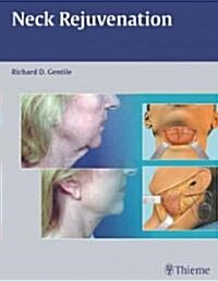 Neck Rejuvenation (Hardcover)