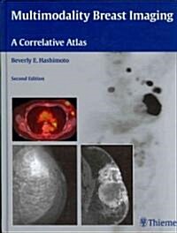 Multimodality Breast Imaging: A Correlative Atlas (Hardcover, 2)