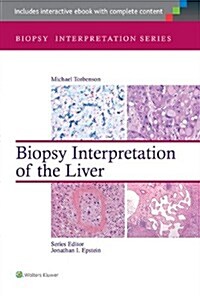 Biopsy Interpretation of the Liver (Hardcover, 3)