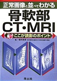 正常畵像と竝べてわかる骨軟部CT·MRI―ここが讀影のポイント (文庫)