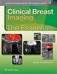 Clinical Breast Imaging: The Essentials (Hardcover)