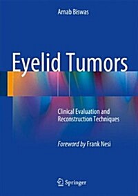 Eyelid Tumors: Clinical Evaluation and Reconstruction Techniques (Hardcover, 2014)