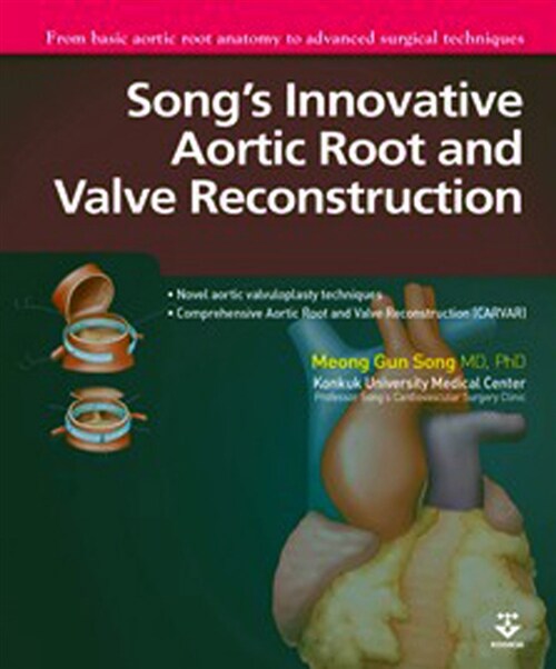 Songs Innovative Aortic Root and Valve Reconstruction 송명근 수술법