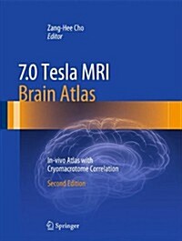 7.0 Tesla MRI Brain Atlas: In-Vivo Atlas with Cryomacrotome Correlation (Hardcover, 2, 2015)