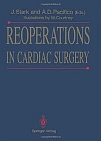 Reoperations in Cardiac Surgery (Paperback, Softcover reprint of the original 1st ed. 1989)