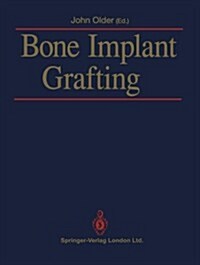 Bone Implant Grafting (Paperback)