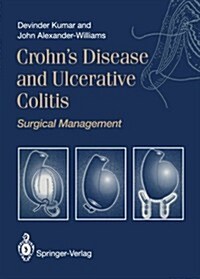 Crohns Disease and Ulcerative Colitis : Surgical Management (Paperback, Softcover reprint of the original 1st ed. 1993)