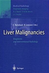 Liver Malignancies: Diagnostic and Interventional Radiology (Paperback, Softcover Repri)