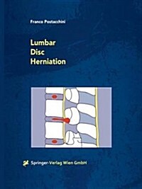Lumbar Disc Herniation (Paperback)