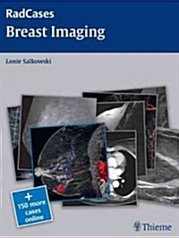 Radcases Breast Imaging (Paperback)