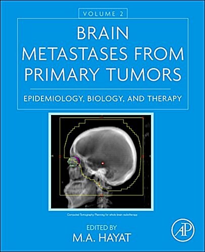 Brain Metastases from Primary Tumors, Volume 2: Epidemiology, Biology, and Therapy (Hardcover)