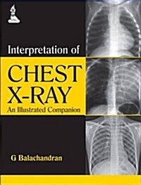Interpretation of Chest X-Ray: An Illustrated Companion (Paperback)
