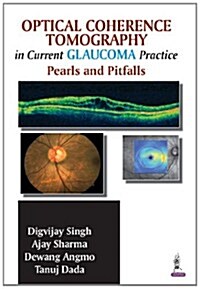 Optical Coherence Tomography in Current Glaucoma Practice: Pearls and Pitfalls (Paperback)