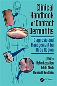 Clinical Handbook of Contact Dermatitis: Diagnosis and Management by Body Region (Paperback)