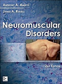 Neuromuscular Disorders, 2nd Edition (Hardcover, 2, Revised)