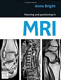 Planning and Positioning in MRI (Paperback)