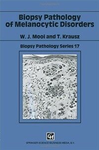 Biopsy pathology of melanocytic disorders 1st ed