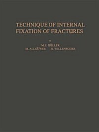 Technique of Internal Fixation of Fractures (Paperback, Softcover Repri)