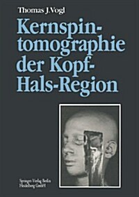 Kernspintomographie Der Kopf-Hals-Region: Funktionelle Topographie -- Klinische Befunde -- Bildgebung -- Spektroskopie (Paperback, Softcover Repri)