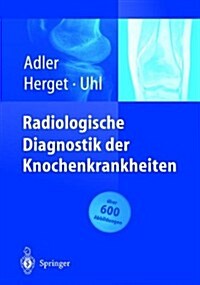 Radiologische Diagnostik Der Knochenkrankheiten (Paperback, Softcover Repri)