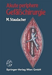 Akute Periphere Gef癌chirurgie (Paperback, Softcover Repri)