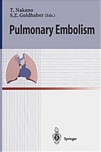 Pulmonary Embolism (Paperback, Softcover Repri)