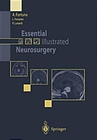 Essential Illustrated Neurosurgery (Paperback, Softcover Repri)