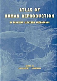 Atlas of Human Reproduction: By Scanning Electron Microscopy (Paperback, Softcover Repri)