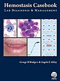 Hemostasis Casebook: Lab Diagnosis & Management (Spiral, 2)