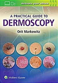 A Practical Guide to Dermoscopy (Hardcover)