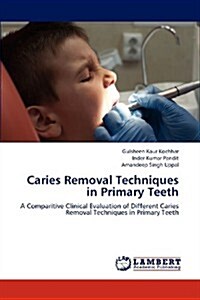 Caries Removal Techniques in Primary Teeth (Paperback)